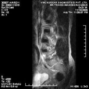 spine-mri-55-300x300
