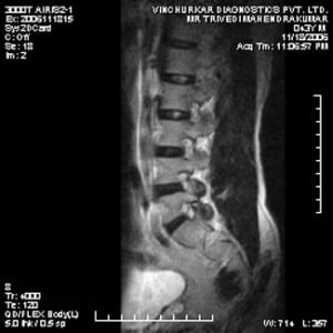 spine-mri-56-300x300