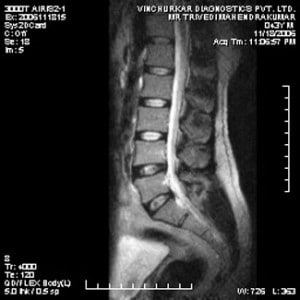 spine-mri-59-300x300
