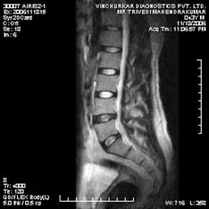 spine-mri-60-300x300