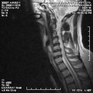 spine-mri-12-300x300