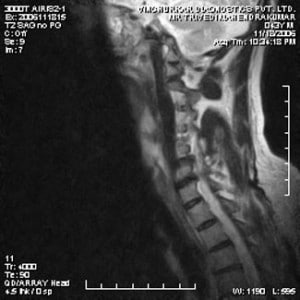 spine-mri-13-300x300