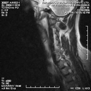 spine-mri-14-300x300