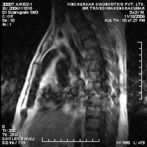 spine-mri-15-300x300