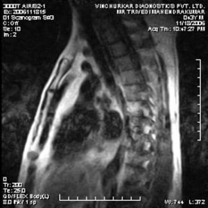 spine-mri-16-300x300