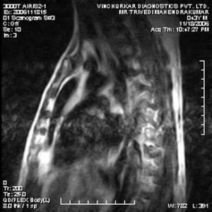 spine-mri-17-300x300