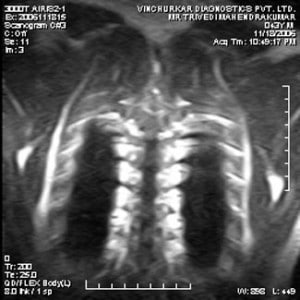 spine-mri-20-300x300