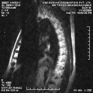 spine-mri-21-300x300