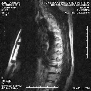 spine-mri-22-300x300