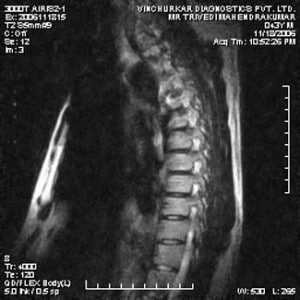 spine-mri-23-300x300