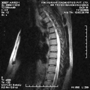 spine-mri-24-300x300