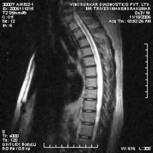 spine-mri-25-300x300