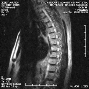 spine-mri-26-300x300