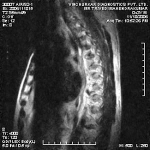 spine-mri-27-300x300