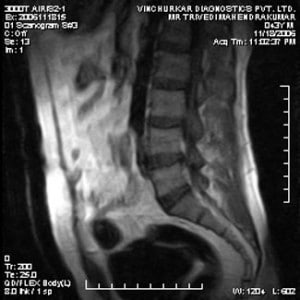 spine-mri-29-300x300