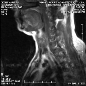 spine-mri-3-300x300