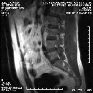 spine-mri-30-300x300