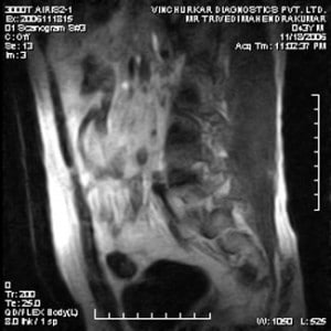 spine-mri-31-300x300