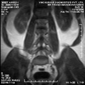 spine-mri-32-300x300