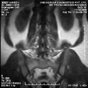 spine-mri-33-300x300