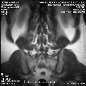 spine-mri-34-300x300