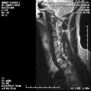 spine-mri-36-300x300 (1)