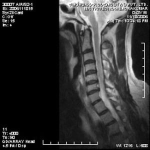 spine-mri-38-300x300