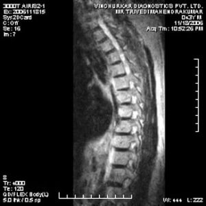 spine-mri-39-300x300