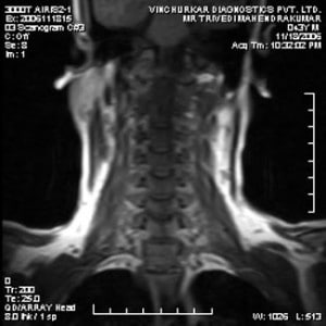 spine-mri-4-300x300