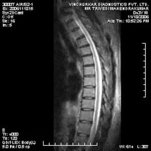 spine-mri-41-300x300