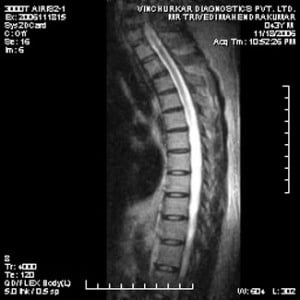 spine-mri-42-300x300