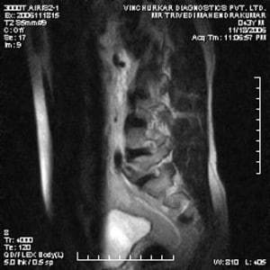 spine-mri-47-300x300