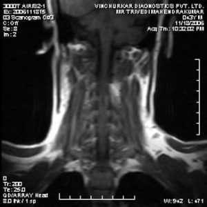 spine-mri-5-300x300