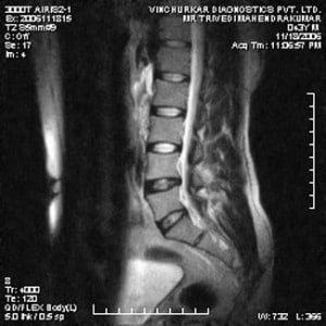 spine-mri-50-300x300