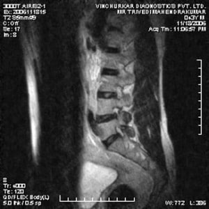 spine-mri-54-300x300