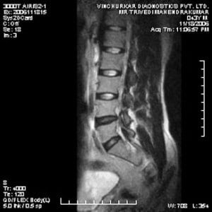 spine-mri-57-300x300