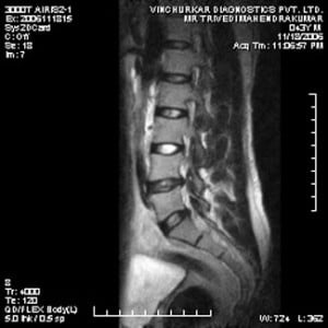 spine-mri-61-300x300