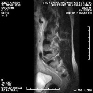 spine-mri-62-300x300