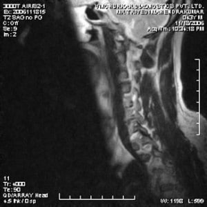 spine-mri-8-300x300